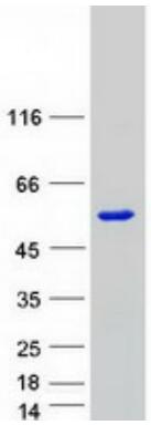 Coomassie blue staining of purified SMAD7 protein.